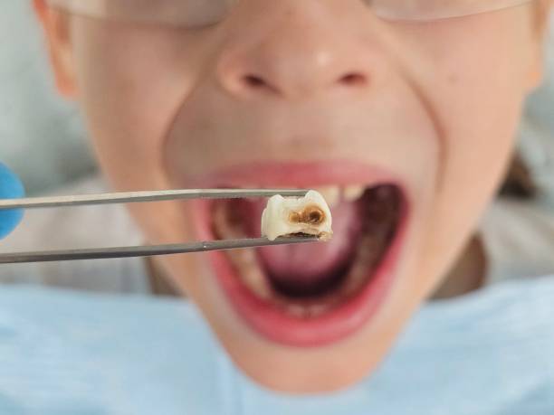 Best Emergency Dentist Near Me  in Bloomingdale, GA